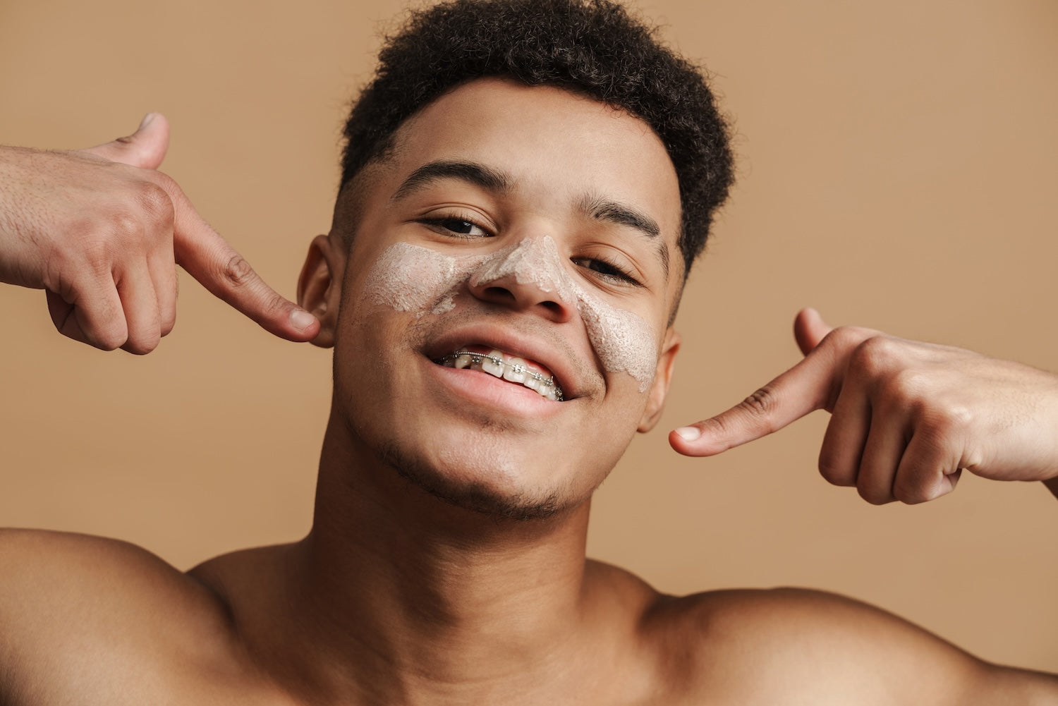 Vaincre l'Acné à l'Adolescence : Guide Complet des Solutions Efficaces